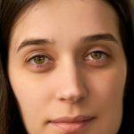 Eye Bag Removal in Riyadh的头像